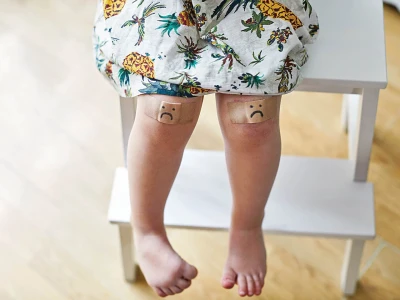 Die�a zakop�va: S� na vine top�nky? Pre�o je spr�vna obuv pre deti k���ov�